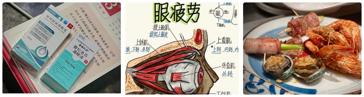 干眼症，结膜炎